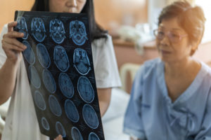 Traumatic Brain Injury in Seniors